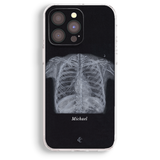 a black and white photo of a skeleton on a phone case