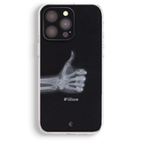 a black phone case with a picture of a skeleton's hand