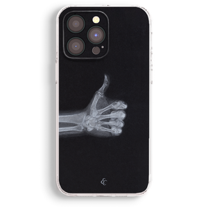 a black and white photo of a skeleton hand