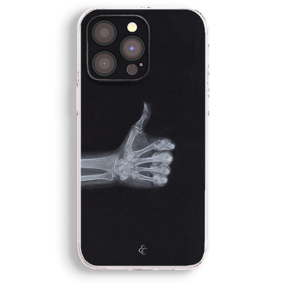 a black and white photo of a skeleton hand
