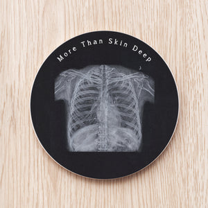 Chest X ray Personalized  Ceramic Coaster