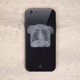Chest X Ray Tempered Glass Phone Case