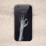 X Ray Tempered Glass Phone Case-I'm OK