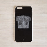Chest X Ray Phone Case