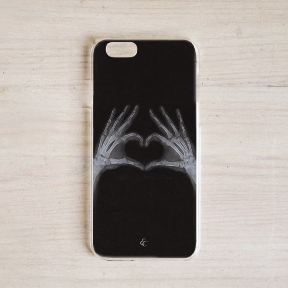 X Ray Phone Case-Heart