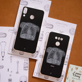 Chest X Ray Phone Case